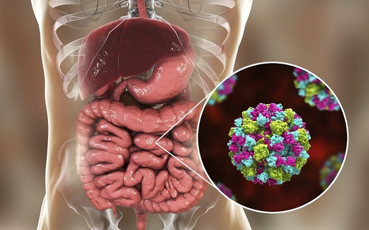 gastroenteritis